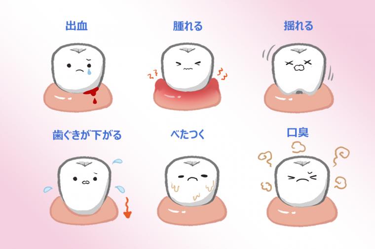 歯周病が招く…本当に怖い合併症