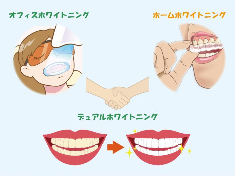 ホワイトニングで白い歯に