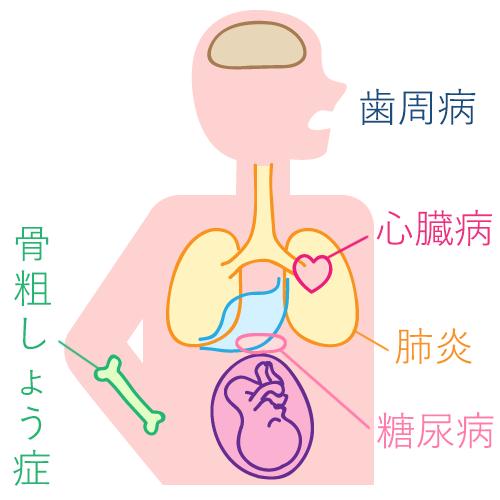 歯周病は生活習慣病